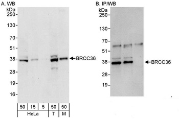 Rabbit BRCC36 Antibody