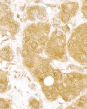 Rabbit anti-MERIT40 Antibody