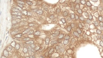 Rabbit anti-NEDD4L Antibody