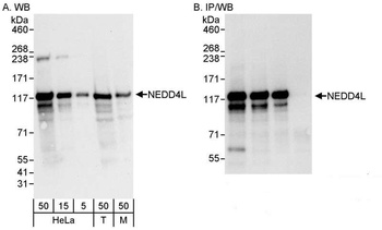 Rabbit NEDD4L Antibody
