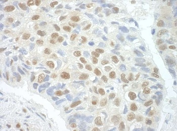 Rabbit anti-POGZ Antibody