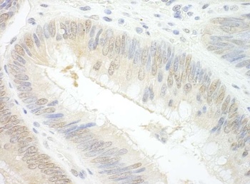 Rabbit anti-EAF2 Antibody