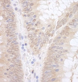 Rabbit anti-EAF2 Antibody