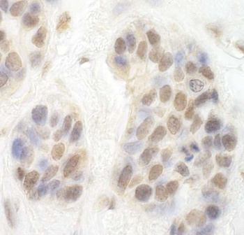 Rabbit CDK8 Antibody