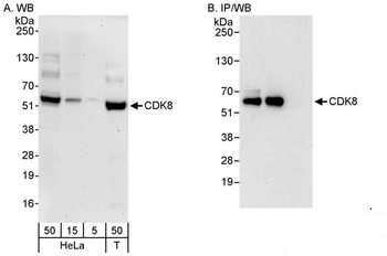 Rabbit CDK8 Antibody