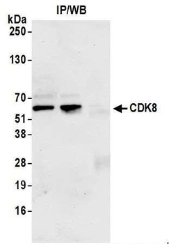 Rabbit CDK8 Antibody