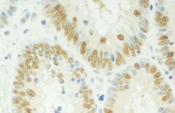 Rabbit anti-SPF45 Antibody