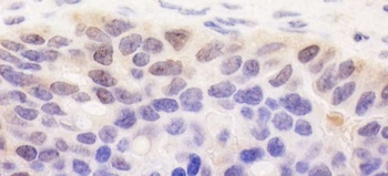 Rabbit anti-SPATA2 Antibody