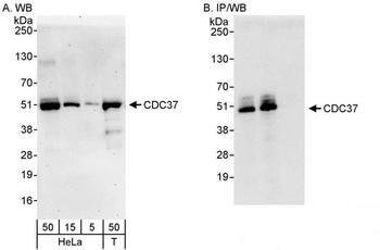 Rabbit CDC37 Antibody