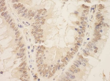 Rabbit ZEB2/SIP Antibody