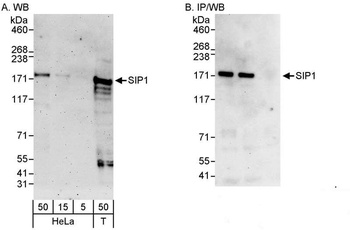 Rabbit ZEB2/SIP Antibody