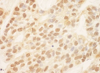 Rabbit ZEB2/SIP Antibody