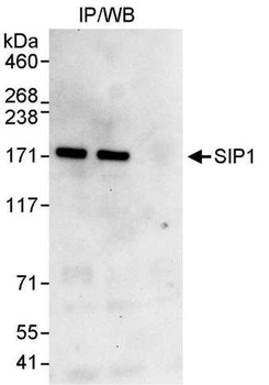 Rabbit ZEB2/SIP Antibody