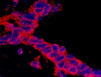 Rabbit anti-CASC3 Antibody