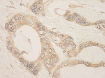 Rabbit anti-CASC3 Antibody