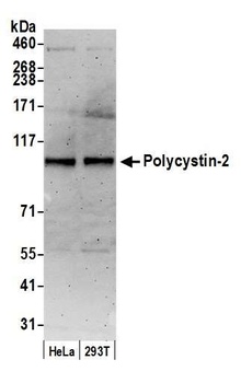 Rabbit Polycystin-2 Antibody