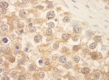 Rabbit SPAK Antibody