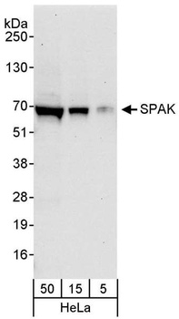 Rabbit SPAK Antibody