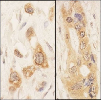 Rabbit SPAK Antibody