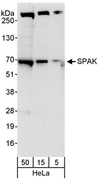 Rabbit SPAK Antibody