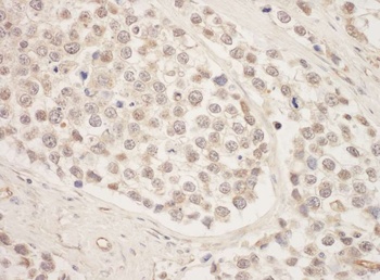 SRPK1 Antibody