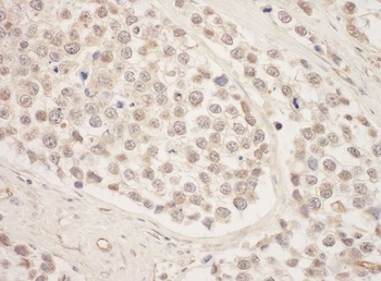 Rabbit anti-SRPK1 Antibody