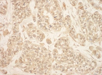 Rabbit anti-RSK2 Antibody