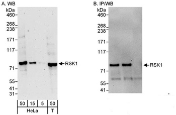 Rabbit RSK1 Antibody