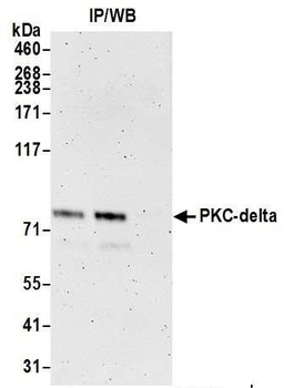 Rabbit PKC-delta Antibody