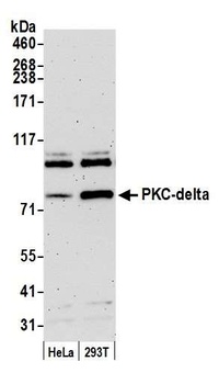 Rabbit PKC-delta Antibody
