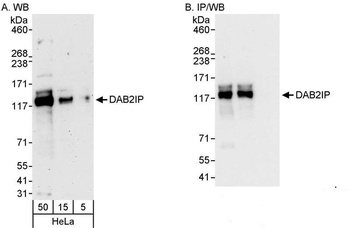 Rabbit anti-DAB2IP Antibody