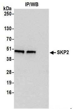 SKP2 Antibody
