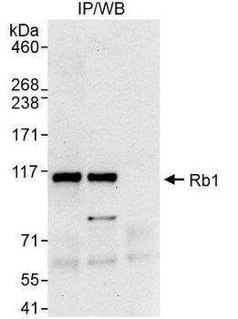 Rabbit Rb1 Antibody