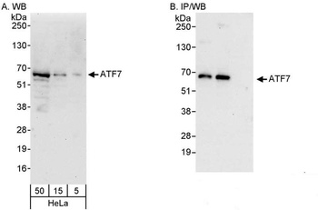 Rabbit ATF7 Antibody