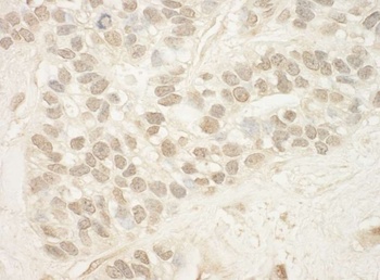 Rabbit anti-MED15 Antibody