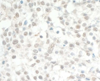 MED13L Antibody