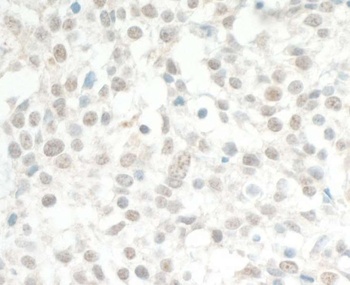 Rabbit MED13L Antibody