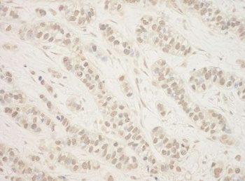 Rabbit BHD Antibody