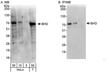 Rabbit BHD Antibody