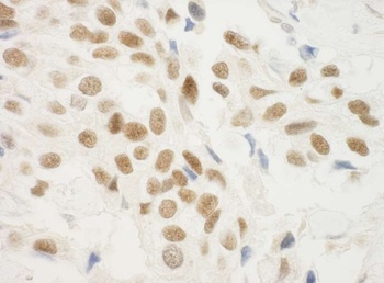 Rabbit anti-ZNF768 Antibody
