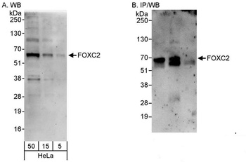 Rabbit FOXC2 Antibody