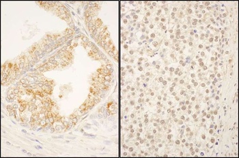 Rabbit anti-FBXO38 Antibody