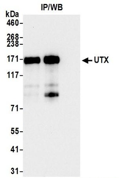 Rabbit UTX Antibody