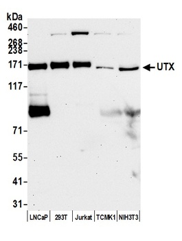 Rabbit UTX Antibody