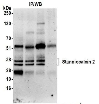 Stanniocalcin 2 Antibody