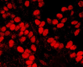 Rabbit anti-HMGN1 Antibody