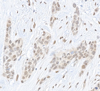 Pc2 Antibody