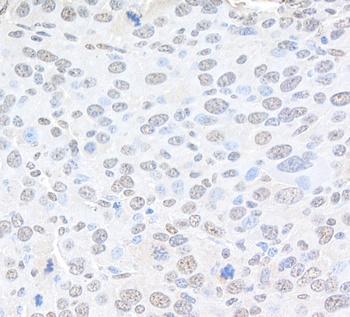 Pc2 Antibody