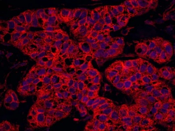 Rabbit anti-Septin 9 Antibody