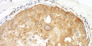 Rabbit anti-Septin 9 Antibody